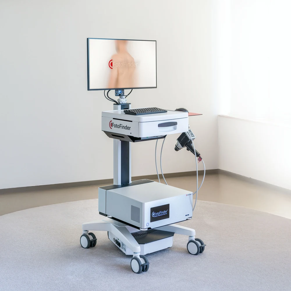 FOTOFINDER Videodermatoscopia